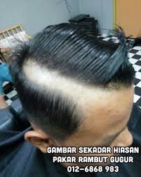 Tags cara mengatasi rambut gugur, cara merawat rambut gugur, masalah rambut gugur, mimpi rambut gugur, petua rambut. Pin Pa Pelebat Rambut Paling Berkesan