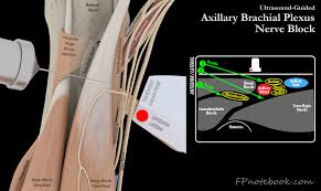 Image result for Axillary Nerve Block