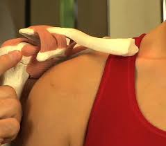 Rotator Cuff Yirtigi Ve Gecmeyen Omuz Agrisi Rotator Cuff Ameliyati