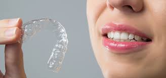 Lingual braces unlike invisalign are cemented on the inside of the teeth and do not rely on patient compliance. How Can I Get Straight Teeth Without Braces Iris Dental Point Cook