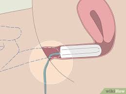 Maybe you would like to learn more about one of these? How To Insert A Tampon Without Applicator With Pictures