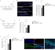 Estadísticas por visitantes del mundo últimos visitantes alemania 1.752, argelia 179, argentina 40.190, a.saudí 183, australia 158, austria 109, bélgica 171. Role Of Adult Hippocampal Neurogenesis In The Antidepressant Actions Of Lactate Molecular Psychiatry