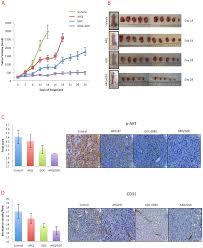 During the biopsy, a surgeon extracts a small sample of tumor tissue or flue to … Plos One Met And Pi3k Mtor As A Potential Combinatorial Therapeutic Target In Malignant Pleural Mesothelioma