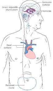 Pin On Critical Care Nursing