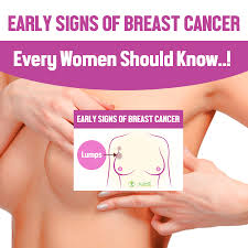 Because it is aggressive and often diagnosed at a late stage, the outlook is the genes brca1 and brca2 are the most common faulty genes. Early Signs Of Breast Cancer
