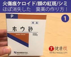 なんと 火傷痕ケロイドや顔の紅斑もほぼ消失する霙 みぞれ 薬の作り方 ケロイド 傷跡 消す 薬