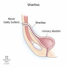 Image result for Umbilicus botryoides
