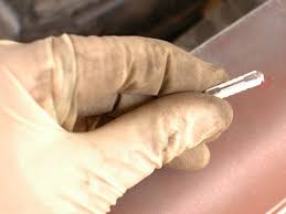 Tutoriels de diagnostic, de réparation et d'entretien. How To Check Mercedes W123 Fuses Ifixit Repair Guide