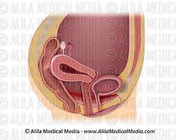 Alila Medical Media Utero Retrovertido Com Sonda De Ultra Som Ilustracao Medica