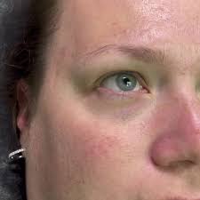 Lift and tint done today. This lasts 6-8 weeks and has no maintenance! 😎