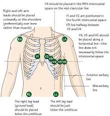 12 leads ekg placement cardiac nursing ekg placement med