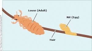 Image result for lice vs nits