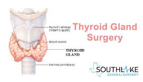 The Process Of Thyroid Gland Removal Is Known As The Thyroid Surgery Or Thyroidectomy The Surgery Requires A Professiona In 2020 Thyroidectomy Thyroid Surgery Thyroid