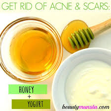 But it is possible to make natural face mask at home without wasting money. Top 5 Yogurt Face Mask Recipes For Acne Cure Control Beautymunsta Free Natural Beauty Hacks And More