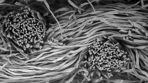 Check spelling or type a new query. Microscopic Images Of Face Masks Show They Slow Spread Of Covid 19 Science News