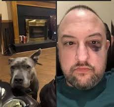 Pit bulls protect owner from intruders