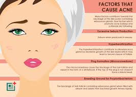 Diagram Of Acne Cyst Catalogue Of Schemas