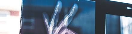 No need to work on your paper at night. Radiologic Technologist Resume X Ray Tech Resume Example