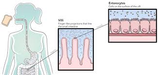 How Celiac Disease Is Triggered Beyondceliac Org
