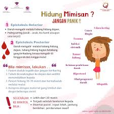 Ada beberapa hal kecil bagi sobat tetapi penting dilakukan untuk mencegah batuk kerng sejak dini. Hidung Mimisan Jangan Panik Rumah Sakit Permata