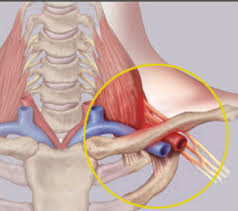 왼쪽 쇄골 아래 통증이 있습니다. : 네이버 블로그