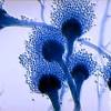 Plusieurs médecins ont appelé lundi à une meilleure prise en compte de l'aspergillose, une maladie des poumons provoquée par un champignon. Https Encrypted Tbn0 Gstatic Com Images Q Tbn And9gct1clj3gc Hbww H Uhmi88gwqgwtmbotu8n Ar8i65q6vr Rd3 Usqp Cau