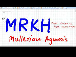 Oct 04, 2012 · mullerian duct anomalies: Mrkh Syndrome Mullerian Agenesis Youtube
