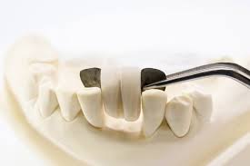 Oklahoma city is a large city and we have the connections to find a dentist to fit your needs, and can get you an appointment immediately. Restorative Dentistry Brixton Family Dental