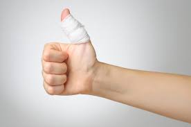 Sprained Thumb | Cause And Recovery Time | Orthoindy Blog