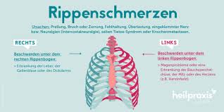Rippenschmerzen Rechts Oder Links Heilpraxis