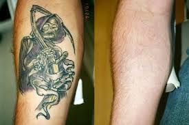 The Best Natural Tattoo Removal Solution Go To Http Tattoo 6p3qdhcw Yourreputablereviews Com Natural Tattoo Removal Tattoo Removal Laser Tattoo Removal