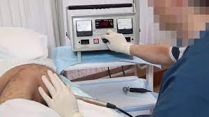 脊髄損傷男性の電気刺激による射精：ビデオ論文 | 松林 秀彦 （生殖医療専門医）のブログ