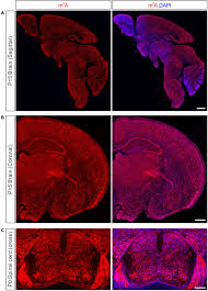 What are you waiting for? Frontiers M6a Modification In Mammalian Nervous System Development Functions Disorders And Injuries Cell And Developmental Biology