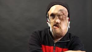 Another surgery sojourn