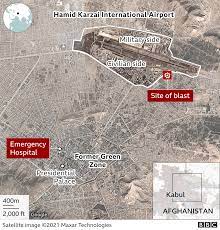 Emergency hospital in kabul said. 9fyps8ukbkneom