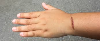 غرفة تنورة دراماتيكي كيفية تنظيف الحروق dsvdedommel com