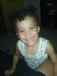 Síndrome de Aicardi