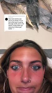 Jordan Beckham Sun Damage