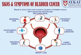 Aykai Hospital Bladder Cancer Is One Of The Most Common Facebook