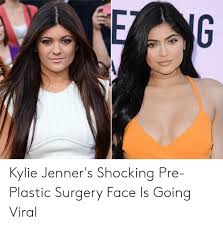 To revisit this article, select my account, thenvi. Eg Kylie Jenner S Shocking Pre Plastic Surgery Face Is Going Viral Plastic Surgery Meme On Me Me