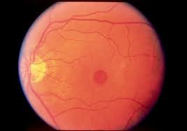 Angeles Vision Clinic Eye Health Optometry Eyes