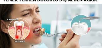 Yemek Yerken Dolgulu Diş Neden Ağrır?