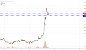 unh stock price and chart nyse unh tradingview