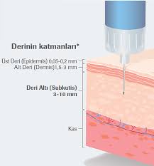 Diyabetevi Nasil Dogru Insulin Enjeksiyonu Yaparim