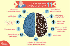11 علامة طبية تدل على سرعة الاقتراب من مرض ألزهايمر إنفوجراف موقع سيدي