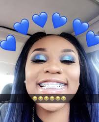 Pin By Xpterwolf Gamer On I M Going To Get Braces For The First Time Cute Braces Colors Cute Braces Braces Colors
