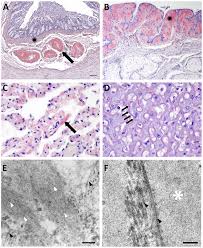 Congo red staining with classical apple green birefringence under polarized light should be used to test for the presence of amyloid on any histological specimen. Congo Red Staining And Electron Microscopy Of Amyloid A Amyloid Download Scientific Diagram