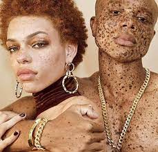 Jacques kruyswijk @ 55/1 with bet365. 175 Biracial Scandinavian Ideas Biracial Curly Hair Styles Natural Hair Styles