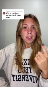 Struggling with Hormonal Acne: A Real Look Behind the Makeup