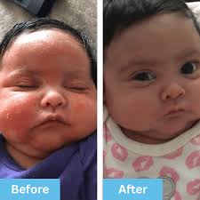 Healing Ointment for Babies & Kids